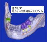 透かして 見えない位置関係が見えてくる